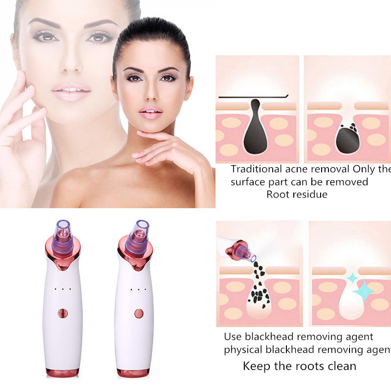 Blackhead Vacuum Cleaner: Pore Perfecting Tool